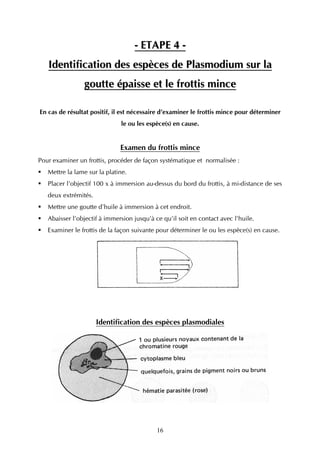 - ETAPE 4 -
   Identification des espèces de Plasmodium sur la
                goutte épaisse et le frottis mince

En cas de résultat positif, il est nécessaire d’examiner le frottis mince pour déterminer
                              le ou les espèce(s) en cause.


                              Examen du frottis mince
Pour examiner un frottis, procéder de façon systématique et normalisée :
   Mettre la lame sur la platine.
   Placer l'objectif 100 x à immersion au-dessus du bord du frottis, à mi-distance de ses
   deux extrémités.
   Mettre une goutte d'huile à immersion à cet endroit.
   Abaisser l'objectif à immersion jusqu'à ce qu'il soit en contact avec l'huile.
   Examiner le frottis de la façon suivante pour déterminer le ou les espèce(s) en cause.




                      Identification des espèces plasmodiales




                                            16
 