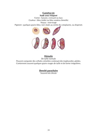Gamétocyte
                             Stade assez fréquent
                       Forme : banane, croissant ou faux
                Couleur : bleu (mâle) ou bleu soutenu (femelle)
                              Noyau : rose-rouge
Pigment : quelques grains bleu- noir situés au centre du cytoplasme, ou dispersés




                                   Hématie
                              De taille normale
 Peuvent comporter des cellules crénelées contenant des trophozoïtes adultes.
 Contiennent souvent quelques grains rouges de taille et de forme irrégulières.


                             Densité parasitaire
                              Souvent très élevée




                                       19
 