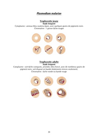 Plasmodium malariae

                              Trophozoïte jeune
                                Stade fréquent
 Cytoplasme : anneau bleu soutenu épais, avec quelques grains de pigments noirs
                      Chromatine : 1 grosse tâche rouges




                              Trophozoïte adulte
                                  Stade fréquent
Cytoplasme : soit tâche compacte, arrondie, bleu foncé, avec de nombreux grains de
       pigment noirs, soit disposé en bande (étalements minces seulement).
                     Chromatine : tâche ronde ou bande rouge




                                       20
 