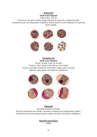 Schizonte
                                  Stade assez fréquent
                                   Mérozoites : 8 à 10
       Chacun est une grosse tâche rouge entourée d’un peu de cytoplasme pâle.
Ils peuvent avoir une disposition irrégulière (forme jeune) ou être disposés en couronne
                                         (forme adulte




                                    Gamétocyte
                                Stade assez fréquent
                          Forme : grand, ovale ou arrondi
                  Couleur : bleu soutenu (femelle) ou clair (mâle)
            Noyau : une tâche ronde de chromatine rouge contre un bord
                   Pigment : gros grains noirs dans le cytoplasme




                                      Hématie
                            De taille et forme normales
     Peuvent comporter des cellules crénelées contenant des trophozoïtes adultes.
     Contiennent souvent quelques grains rouges de taille et de forme irrégulières.


                                Densité parasitaire
                                        Faible


                                          21
 