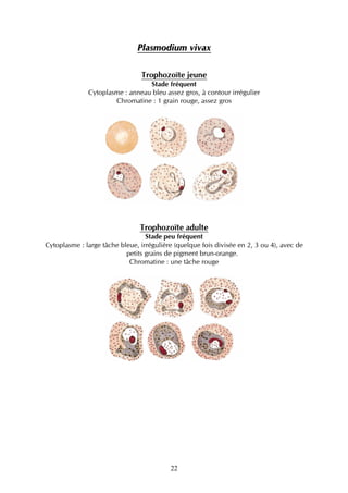 Plasmodium vivax

                                Trophozoïte jeune
                                 Stade fréquent
              Cytoplasme : anneau bleu assez gros, à contour irrégulier
                      Chromatine : 1 grain rouge, assez gros




                                Trophozoïte adulte
                                  Stade peu fréquent
Cytoplasme : large tâche bleue, irrégulière (quelque fois divisée en 2, 3 ou 4), avec de
                           petits grains de pigment brun-orange.
                            Chromatine : une tâche rouge




                                          22
 