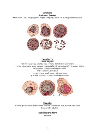 Schizonte
                                Stade assez fréquent
Mérozoites : 12 à 18 gros grains rouges compacts, posés sur le cytoplasme bleu pâle




                                  Gamétocyte
                                  Stade fréquent
        Femelle : ovale ou arrondi, bleu soutenu (femelle) ou clair (mâle)
   Noyau triangulaire rouge soutenu, souvent placé à une extrémité; nombreux grains
                        de pigments orange dans le cytoplasme.
                             Mâle : arrondi, bleu clair
                       Noyau central rond, rouge clair; quelques
                     grains de pigments orange dans le cytoplasme




                                    Hématie
  Grosses granulations de Schüffner, souvent colorées en rose, surtout autour des
                                 trophozoïtes adultes.

                              Densité parasitaire
                                    Moyenne




                                        23
 