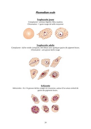 Plasmodium ovale

                               Trophozoïte jeune
                     Cytoplasme : anneau régulier, bleu soutenu
                    Chromatine : 1 grain rouge de taille moyenne




                               Trophozoïte adulte
Cytoplasme : tâche ronde compacte, très bleue avec quelques grains de pigment bruns.
                        Chromatine : une grosse tâche rouge




                                    Schizonte
 Mérozoites : 8 à 14 grosses tâches rouges en couronne, autour d’un amas central de
                                 grains de pigments bruns.




                                        24
 