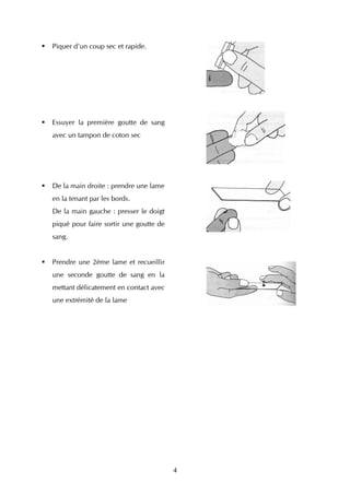 Piquer d'un coup sec et rapide.




Essuyer la première goutte de sang
avec un tampon de coton sec




De la main droite : prendre une lame
en la tenant par les bords.
De la main gauche : presser le doigt
piqué pour faire sortir une goutte de
sang.


Prendre une 2ème lame et recueillir
une seconde goutte de sang en la
mettant délicatement en contact avec
une extrémité de la lame




                                        4
 