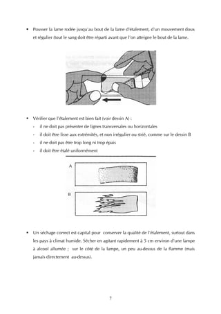 Pousser la lame rodée jusqu'au bout de la lame d'étalement, d'un mouvement doux
et régulier (tout le sang doit être réparti avant que l'on atteigne le bout de la lame.




Vérifier que l'étalement est bien fait (voir dessin A) :
-   il ne doit pas présenter de lignes transversales ou horizontales
-   il doit être lisse aux extrémités, et non irrégulier ou strié, comme sur le dessin B
-   il ne doit pas être trop long ni trop épais
-   il doit être étalé uniformément




Un séchage correct est capital pour conserver la qualité de l'étalement, surtout dans
les pays à climat humide. Sécher en agitant rapidement à 5 cm environ d'une lampe
à alcool allumée ; sur le côté de la lampe, un peu au-dessus de la flamme (mais
jamais directement au-dessus).




                                           7
 