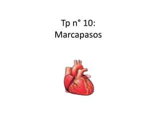 Tp n° 10:
Marcapasos
 