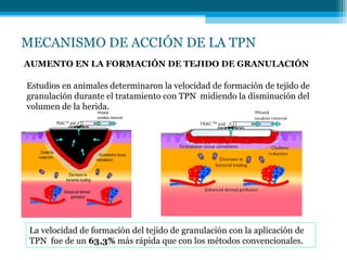 MECANISMO DE ACCIÓN DE LA TPN
AUMENTO EN LA FORMACIÓN DE TEJIDO DE GRANULACIÓN
Estudios en animales determinaron la velocidad de formación de tejido de
granulación durante el tratamiento con TPN midiendo la disminución del
volumen de la herida.
La velocidad de formación del tejido de granulación con la aplicación de
TPN fue de un 63,3% más rápida que con los métodos convencionales.
 