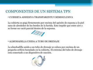 COMPONENTES DE UN SISTEMA TPN
• CUBIERTA ADHESIVA TRANSPARENTE Y SEMIOCLUSIVA
La cubierta se pega firmemente por encima del apósito de espuma a la piel
sana de alrededor de los bordes de la herida. Esto impide que entre aire y
se forme un vació parcial dentro de la espuma.
• ALMOHADILLA UNIDA A TUBO DE DRENAJE
La almohadilla unida a un tubo de drenaje se coloca por encima de un
pequeño orificio horadado en la cubierta. El extremo del tubo de drenaje
esta conectado a un dispositivo de succión.
 