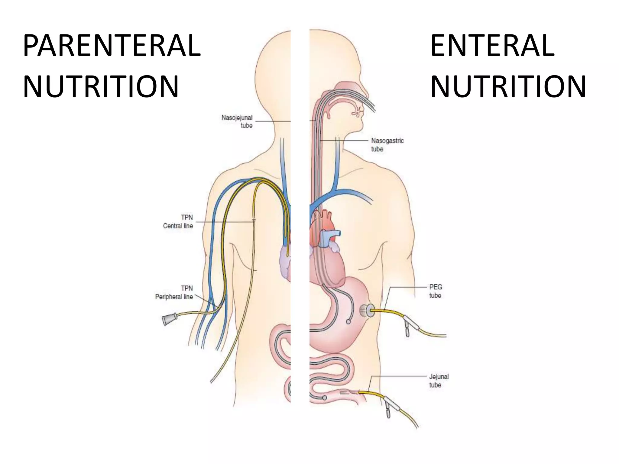 Total Parenteral Nutrition : Types, Preparation, Indication and ...