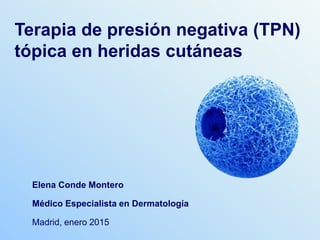Elena Conde Montero
Médico Especialista en Dermatología
Madrid, enero 2015
Terapia de presión negativa (TPN)
en heridas cutáneas
 