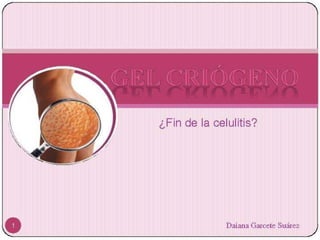 Chau celulitis