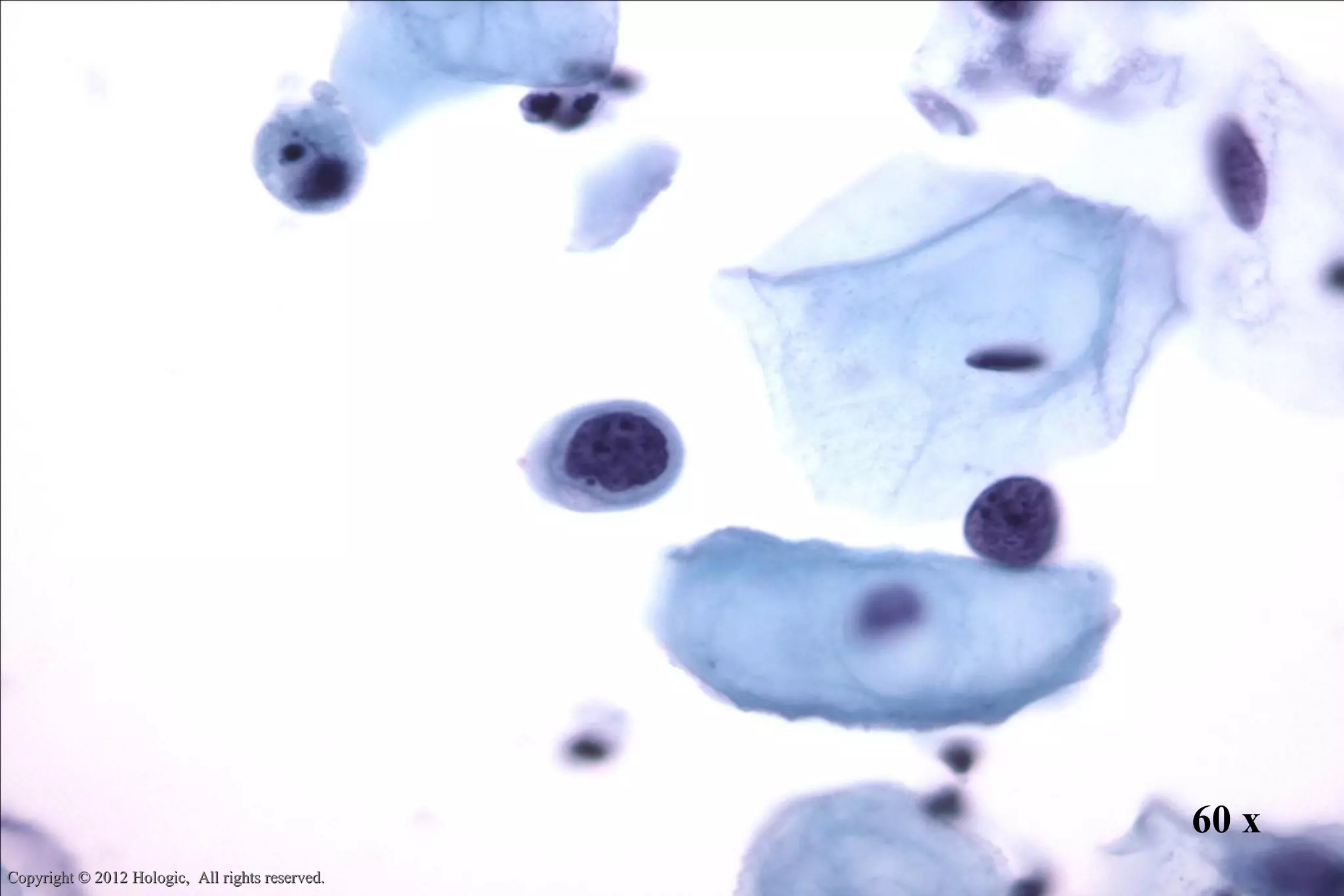 Thin prep morphology (Cervical cytology) | PPT