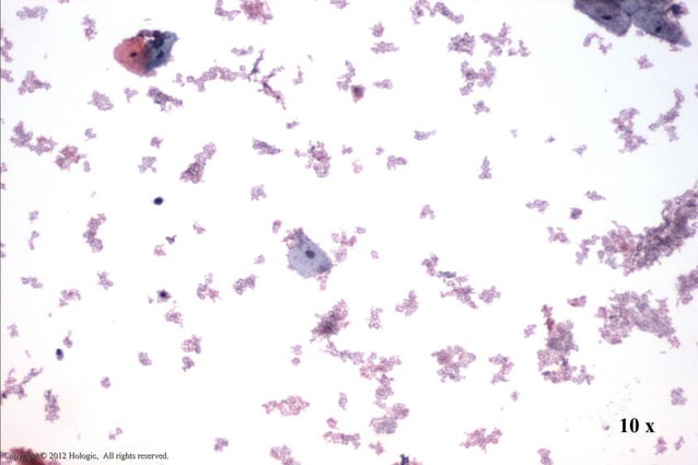 Thin prep morphology (Cervical cytology) | PPT