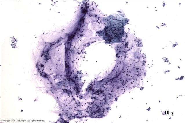 Thin prep morphology (Cervical cytology) | PPT