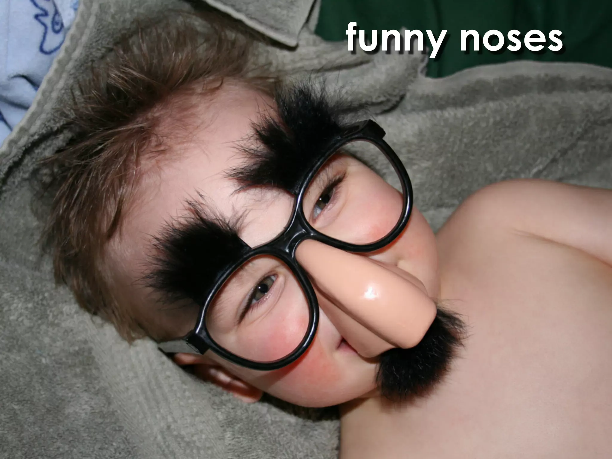 funny noses
 