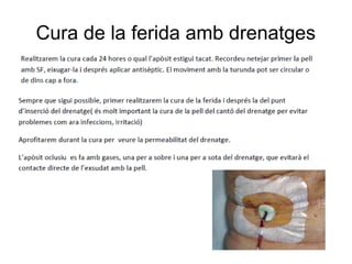 Cura de la ferida amb drenatges
 