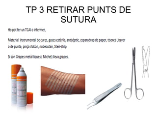 TP 3 RETIRAR PUNTS DE
SUTURA
 