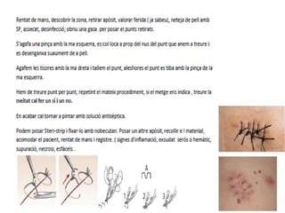 Tp's bloc quirúrgic