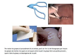 Tp's bloc quirúrgic