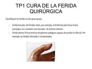 TP1 CURA DE LA FERIDA
QUIRÚRGICA
 