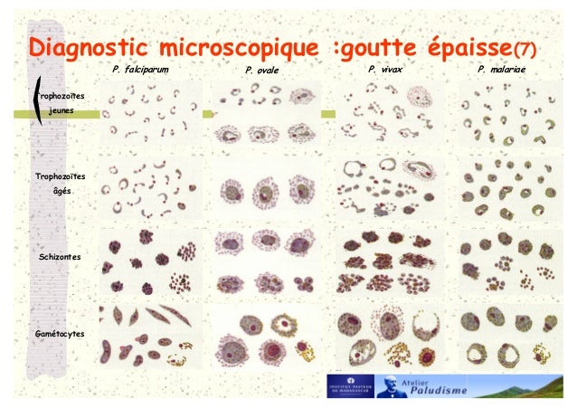 SP Diagnostic Frottis Gouttes paisses Tests Rapides Diagnostic 1 sp-diagnostic-frottis-gouttes-paisses-tests-rapides-diagnostic-1