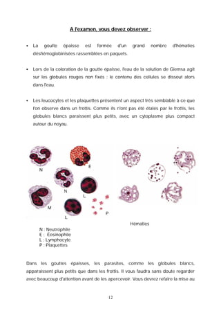 A l'examen, vous devez observer :


   La     goutte   épaisse   est   formée    d'un   grand      nombre   d'hématies
    déshémoglobinisées rassemblées en paquets.


   Lors de la coloration de la goutte épaisse, l'eau de la solution de Giemsa agit
    sur les globules rouges non fixés : le contenu des cellules se dissout alors
    dans l'eau.


   Les leucocytes et les plaquettes présentent un aspect très semblable à ce que
    l'on observe dans un frottis. Comme ils n'ont pas été étalés par le frottis, les
    globules blancs paraissent plus petits, avec un cytoplasme plus compact
    autour du noyau.




                                                     Hématies
         N : Neutrophile
         E : Éosinophile
         L : Lymphocyte
         P : Plaquettes



Dans les gouttes épaisses, les parasites, comme les globules blancs,
apparaissent plus petits que dans les frottis. Il vous faudra sans doute regarder
avec beaucoup d'attention avant de les apercevoir. Vous devrez refaire la mise au



                                         12
 