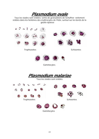 Plasmodium ovale
  Tous les stades sont visibles; semis de granulations de Schüffner nettement
visibles dans les fantômes des érythrocytes de l’hôte, surtout sur les bords de la
                               goutte épaisse




            Trophozoïtes                                        Schizontes




                                  Gamétocytes




                 Plasmodium malariae
                           Tous les stades sont visibles




           Trophozoïtes                                     Schizontes




                                 Gamétocytes




                                        15
 