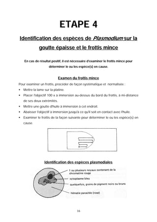 ETAPE 4
Identification des espèces de Plasmodium sur la
               goutte épaisse et le frottis mince

    En cas de résultat positif, il est nécessaire d’examiner le frottis mince pour
                      déterminer le ou les espèce(s) en cause.


                              Examen du frottis mince
Pour examiner un frottis, procéder de façon systématique et normalisée :
   Mettre la lame sur la platine.
   Placer l'objectif 100 x à immersion au-dessus du bord du frottis, à mi-distance
    de ses deux extrémités.
   Mettre une goutte d'huile à immersion à cet endroit.
   Abaisser l'objectif à immersion jusqu'à ce qu'il soit en contact avec l'huile.
   Examiner le frottis de la façon suivante pour déterminer le ou les espèce(s) en
    cause.




                   Identification des espèces plasmodiales




                                           16
 