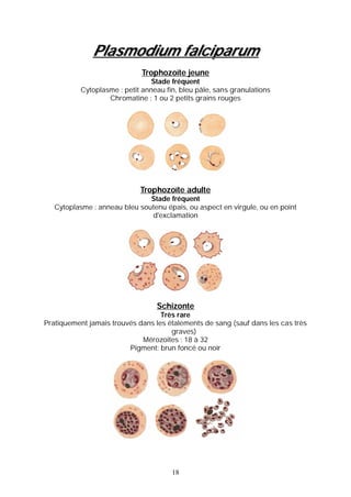 Plasmodium falciparum
                             Trophozoïte jeune
                                 Stade fréquent
           Cytoplasme : petit anneau fin, bleu pâle, sans granulations
                   Chromatine : 1 ou 2 petits grains rouges




                             Trophozoïte adulte
                               Stade fréquent
   Cytoplasme : anneau bleu soutenu épais, ou aspect en virgule, ou en point
                               d'exclamation




                                  Schizonte
                                   Très rare
Pratiquement jamais trouvés dans les étalements de sang (sauf dans les cas très
                                      graves)
                             Mérozoites : 18 à 32
                         Pigment: brun foncé ou noir




                                       18
 