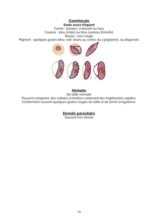 Gamétocyte
                              Stade assez fréquent
                       Forme : banane, croissant ou faux
                 Couleur : bleu (mâle) ou bleu soutenu (femelle)
                               Noyau : rose-rouge
Pigment : quelques grains bleu- noir situés au centre du cytoplasme, ou dispersés




                                   Hématie
                              De taille normale
 Peuvent comporter des cellules crénelées contenant des trophozoïtes adultes.
 Contiennent souvent quelques grains rouges de taille et de forme irrégulières.


                             Densité parasitaire
                              Souvent très élevée




                                       19
 