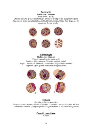 Schizonte
                            Stade assez fréquent
                              Mérozoites : 8 à 10
  Chacun est une grosse tâche rouge entourée d’un peu de cytoplasme pâle.
Ils peuvent avoir une disposition irrégulière (forme jeune) ou être disposés en
                               couronne (forme adulte




                                Gamétocyte
                            Stade assez fréquent
                       Forme : grand, ovale ou arrondi
               Couleur : bleu soutenu (femelle) ou clair (mâle)
        Noyau : une tâche ronde de chromatine rouge contre un bord
               Pigment : gros grains noirs dans le cytoplasme




                                  Hématie
                        De taille et forme normales
Peuvent comporter des cellules crénelées contenant des trophozoïtes adultes.
Contiennent souvent quelques grains rouges de taille et de forme irrégulières.


                            Densité parasitaire
                                    Faible



                                      21
 