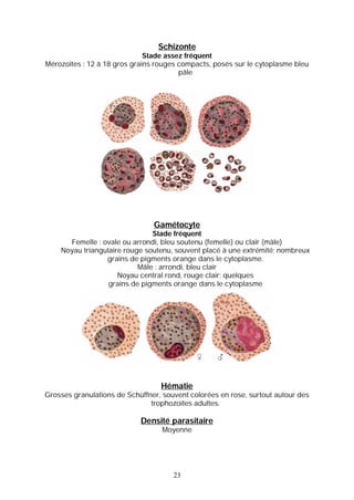Schizonte
                              Stade assez fréquent
Mérozoites : 12 à 18 gros grains rouges compacts, posés sur le cytoplasme bleu
                                        pâle




                                Gamétocyte
                               Stade fréquent
      Femelle : ovale ou arrondi, bleu soutenu (femelle) ou clair (mâle)
    Noyau triangulaire rouge soutenu, souvent placé à une extrémité; nombreux
                 grains de pigments orange dans le cytoplasme.
                           Mâle : arrondi, bleu clair
                     Noyau central rond, rouge clair; quelques
                  grains de pigments orange dans le cytoplasme




                                  Hématie
Grosses granulations de Schüffner, souvent colorées en rose, surtout autour des
                               trophozoïtes adultes.

                            Densité parasitaire
                                   Moyenne




                                      23
 