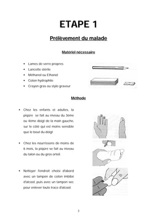 ETAPE 1
                       Prélèvement du malade

                                  Matériel nécessaire


       Lames de verre propres
       Lancette stérile
       Méthanol ou Ethanol
       Coton hydrophile
       Crayon gras ou stylo graveur


                                       Méthode


   Chez les enfants et adultes, la
    piqûre se fait au niveau du 3ème
    ou 4ème doigt de la main gauche,
    sur le côté qui est moins sensible
    que le bout du doigt


   Chez les nourrissons de moins de
    6 mois, la piqûre se fait au niveau
    du talon ou du gros orteil.




   Nettoyer l'endroit choisi d'abord
    avec un tampon de coton imbibé
    d'alcool, puis avec un tampon sec
    pour enlever toute trace d'alcool.




                                           3
 