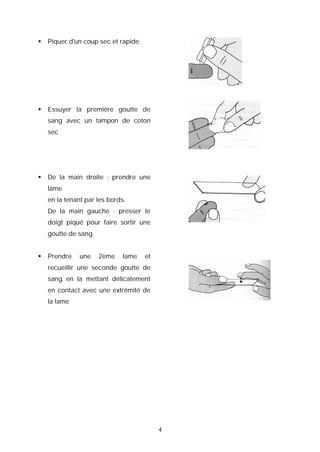    Piquer d'un coup sec et rapide.




   Essuyer la première goutte de
    sang avec un tampon de coton
    sec




   De la main droite : prendre une
    lame
    en la tenant par les bords.
    De la main gauche : presser le
    doigt piqué pour faire sortir une
    goutte de sang.


   Prendre    une    2ème    lame    et
    recueillir une seconde goutte de
    sang en la mettant délicatement
    en contact avec une extrémité de
    la lame




                                           4
 