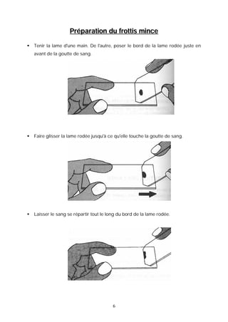 Préparation du frottis mince

   Tenir la lame d'une main. De l'autre, poser le bord de la lame rodée juste en
    avant de la goutte de sang.




   Faire glisser la lame rodée jusqu'à ce qu'elle touche la goutte de sang.




   Laisser le sang se répartir tout le long du bord de la lame rodée.




                                          6
 
