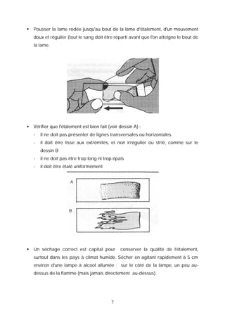    Pousser la lame rodée jusqu'au bout de la lame d'étalement, d'un mouvement
    doux et régulier (tout le sang doit être réparti avant que l'on atteigne le bout de
    la lame.




   Vérifier que l'étalement est bien fait (voir dessin A) :
    -   il ne doit pas présenter de lignes transversales ou horizontales
    -   il doit être lisse aux extrémités, et non irrégulier ou strié, comme sur le
        dessin B
    -   il ne doit pas être trop long ni trop épais
    -   il doit être étalé uniformément




   Un séchage correct est capital pour          conserver la qualité de l'étalement,
    surtout dans les pays à climat humide. Sécher en agitant rapidement à 5 cm
    environ d'une lampe à alcool allumée ; sur le côté de la lampe, un peu au-
    dessus de la flamme (mais jamais directement au-dessus).




                                            7
 