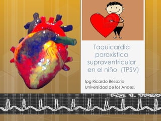 Taquicardia
paroxística
supraventricular
en el niño (TPSV)
Ipg Ricardo Belisario
Universidad de los Andes.
 
