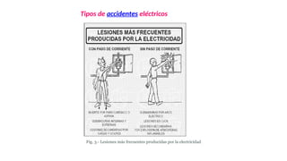 A
C C
IO N
E S
IN S
E
G U
R
A S
S
U B
E
S T
A
N D
A R
N O
U T
IL
I Z
A
R
H
E R
R
A
M IE N
T
A S
A
D E
C
U A
D A
S
.
N
O U
S A
R
E L
E
M E
N T
O
S
D
E
P R
O T
E
C C
IÓ N
P
E
R S
O
N A
L
C
O
N E
C T
A
R T
O M
A S
D E
C
O
R R
IE N
T
E S
C O
N
M
A N
O S
M O
J A
D
A S
.
C
O
M E
T E
R
A C
T O
S
T
E
M E
R
A R
IO S
.
EF EC T O D
E LA CO R RIE N TE
EL ÉC TR IC A E N
E L SE R H
U M AN O
Tipos de accidentes eléctricos
Fig. 3.- Lesiones más frecuentes producidas por la electricidad.
 