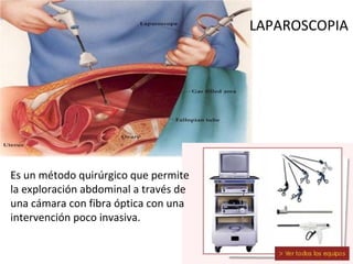 Conducta Diagnostico y Tratamiento
• Laparoscopia
• Laparotomía
• Laparotomía con biopsia de congelación y
Estadificación ...
