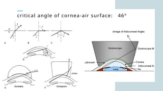 critical angle of cornea-air surface: 46º
 