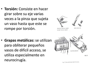 • Torsión: Consiste en hacer
  girar sobre su eje varias
  veces a la pinza que sujeta
  un vaso hasta que este se
  rompe por torsión.

• Grapas metálicas: se utilizan
  para obliterar pequeños
  vasos de difícil acceso, se
  utiliza especialmente en
  neurocirugía.
 