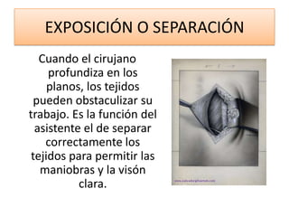 EXPOSICIÓN O SEPARACIÓN
   Cuando el cirujano
     profundiza en los
     planos, los tejidos
  pueden obstaculizar su
trabajo. Es la función del
  asistente el de separar
    correctamente los
 tejidos para permitir las
   maniobras y la visón
           clara.
 