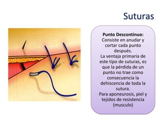 Suturas
   Punto Descontinuo:
  Consiste en anudar y
    cortar cada punto
         después.
 La ventaja primaria de
este tipo de suturas, es
  que la pérdida de un
   punto no trae como
     consecuencia la
 dehiscencia de toda la
          sutura.
Para aponeurosis, piel y
  tejidos de resistencia
        (musculo)
 