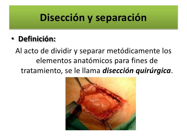 TIEMPOS QUIRURGICOS