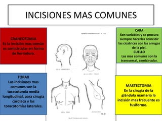 INCISIONES MAS COMUNES
CARA
Son variables y se procura
siempre hacerlas coincidir
las cicatrices con las arrugas
de la piel.
CUELLO
Las mas comunes son la
transversal, semicircular.
MASTECTOMIA
En la cirugía de la
glándula mamaria la
incisión mas frecuente es
fusiforme.
TORAX
Las incisiones mas
comunes son la
toracotomía media
longitudinal, para cirugía
cardiaca y las
toracotomías laterales.
CRANEOTOMIA
Es la incisión mas común
es semicircular en forma
de herradura.
 