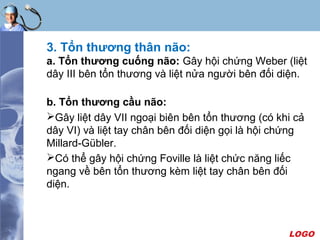 LOGO
3. Tổn thương thân não:
a. Tổn thương cuống não: Gây hội chứng Weber (liệt
dây III bên tổn thương và liệt nửa người bên đối diện.
b. Tổn thương cầu não:
Gây liệt dây VII ngoại biên bên tổn thương (có khi cả
dây VI) và liệt tay chân bên đối diện gọi là hội chứng
Millard-Gübler.
Có thể gây hội chứng Foville là liệt chức năng liếc
ngang về bên tổn thương kèm liệt tay chân bên đối
diện.
 
