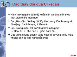 LOGO
Các thay đổi của CT-scan
 Hiện tượng giảm đậm độ xuất hiện và tăng dần theo
thời gian thiếu máu não
 Sự giảm đậm độ thay đổi tùy theo vùng tổn thương và
độ nặng của tình trạng thiếu máu
 Lưu lượng máu < 9 ml/100grams não/phút
→ Hoại tử = phù não = giảm đậm độ
 Các vùng chung quanh vùng hoại tử là vùng thiếu máu
nhưng còn có khả năng hồi phục
 