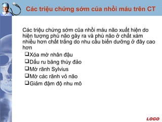 LOGO
Các triệu chứng sớm cũa nhồi máu não xuất hiện do
hiện tượng phù não gây ra và phù não ở chất xám
nhiều hơn chất trắng do nhu cầu biến dưỡng ở đây cao
hơn
Xóa mờ nhân đậu
Dấu ru băng thùy đảo
Mờ rãnh Sylvius
Mờ các rãnh vỏ não
Giảm đậm độ nhu mô
Các triệu chứng sớm của nhồi máu trên CT
 