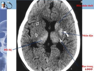 LOGO
Nhân đậu
Bao trong
Đầu nhân đuôi
Đồi thị
 