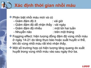 LOGO
Xác định thời gian nhồi máu
 Phân biệt nhồi máu mới và cũ
- Giảm đậm độ ít : vài giờ
- Giảm đậm độ dễ nhận thấy : vài ngày
- Giảm đậm độ nhiều : một tới hai tuần
- Nhuyễn não : trên một tháng
 Fogging effect: hiện tượng đồng đậm độ vùng nhồi máu
ở ngày 14-21 do tăng thực bào hoặc xuất huyết vi thể,
khi đó vùng nhồi máu rất khó nhận thấy.
 Một số trường hợp có hiện tượng tăng quang do xuất
huyết trong vùng nhồi máu vào sau ngày thứ ba.
 